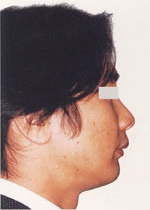 ÑO