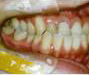 ÑOE