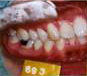 ÑOE