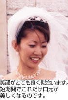 結婚式